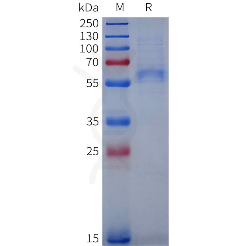 Human VWF(764-1238) Protein, His Tag-VWF重组蛋白（N-10×His tag）-缔码生物