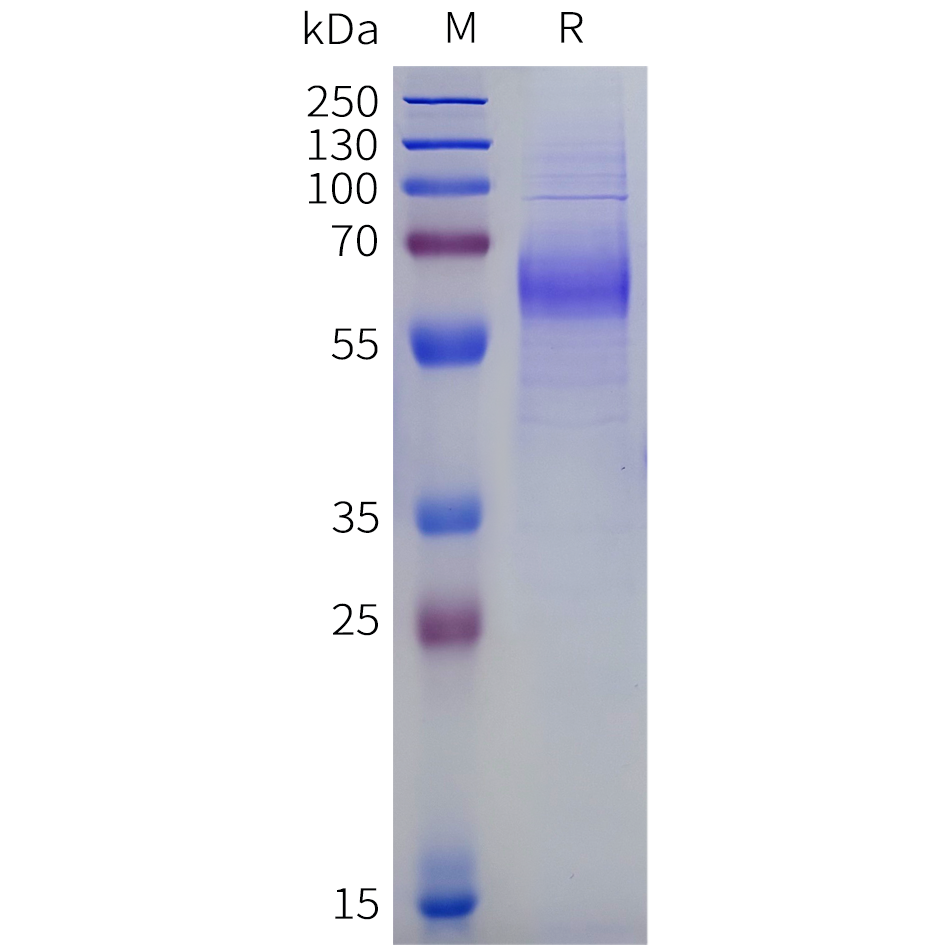 sp-pme101944 gabbr2 sp1