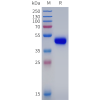 sp-pme102010 igf 1r sp1
