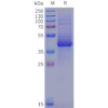sp-pme102019 il12rb1 sp1