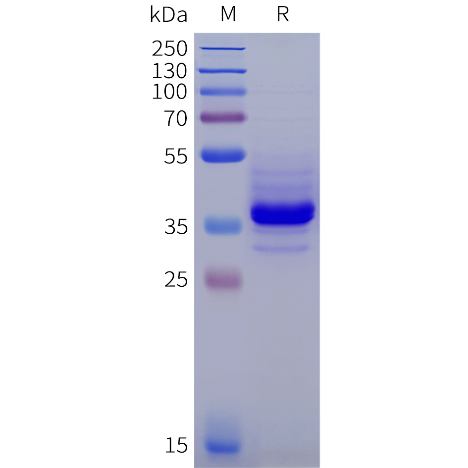 pme102024-il11ra-sp1.png