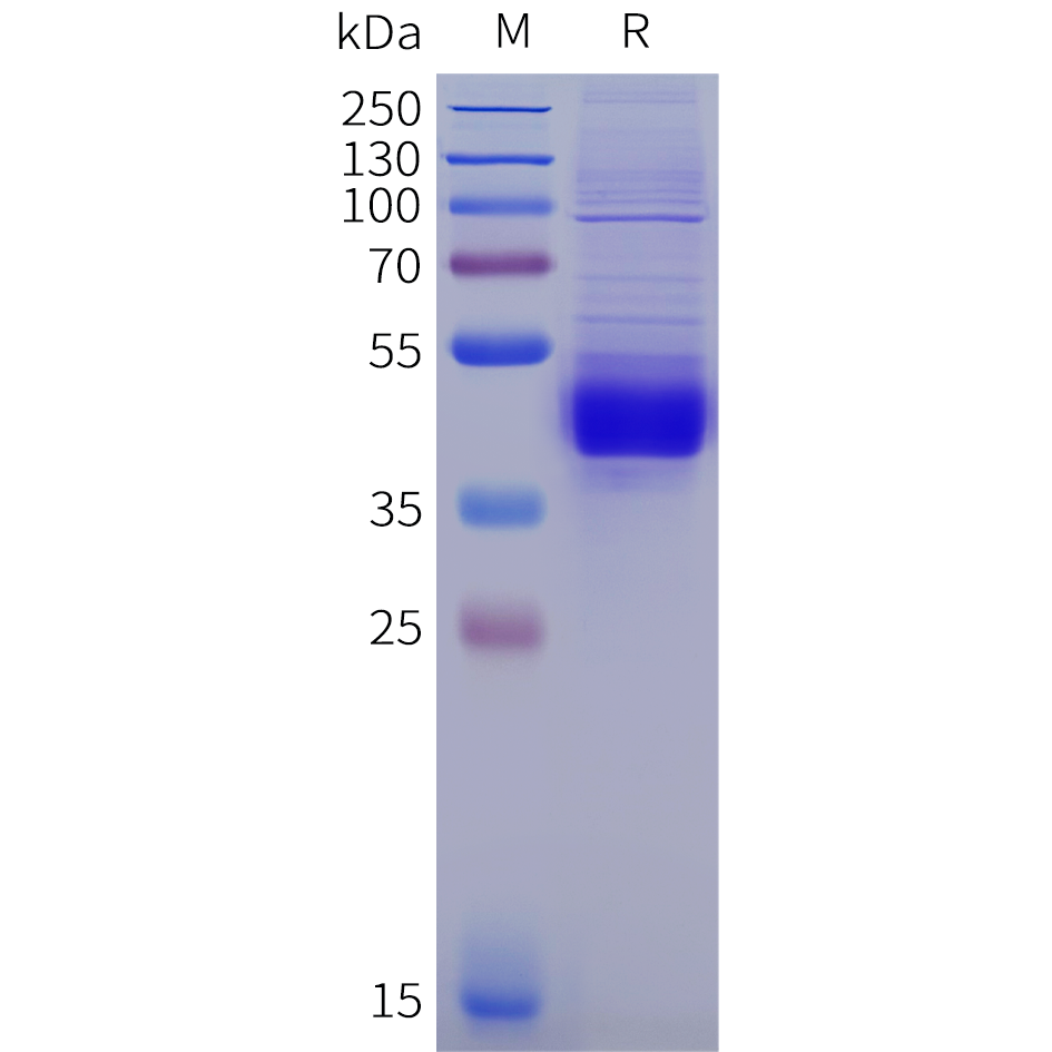 pme102025-il11ra-sp1.png