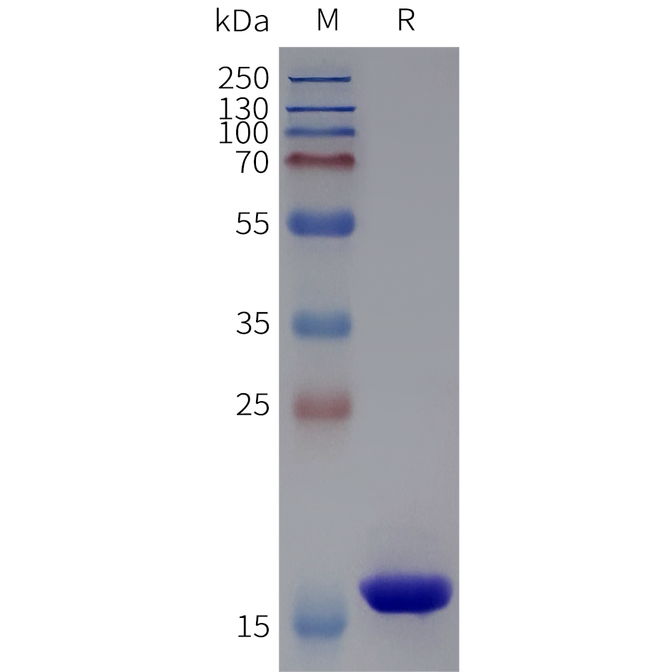 pme102030-sortase-a-sp1.png