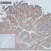 ihc-sli100004 huh7 ihc1