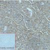 ihc-sli100008 daudi ihc1