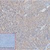ihc-sli100013 raji ihc1