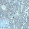ihc-sli100015 lncap ihc1