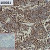 ihc-sli100021 ags ihc1
