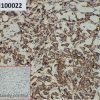 ihc-sli100022 sk br 3 ihc1