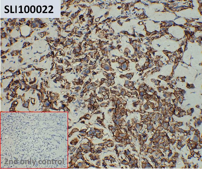 ihc-sli100022 sk br 3 ihc1