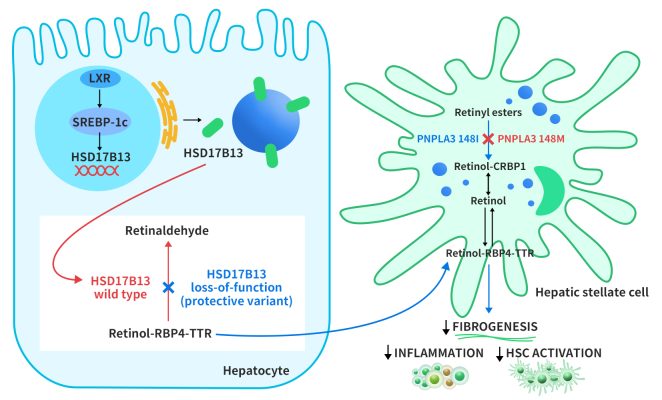 Proposed role of HSD17B13 in modulating disease progression in NAFLD